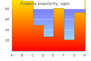 finpecia 1 mg amex