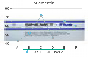 discount augmentin uk