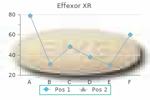 purchase 75 mg effexor xr with visa